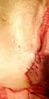 Photo #2. Complaint-review: Pholosong Hospital - Physical abuse amd verbal abuse.