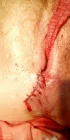 Photo #1. Complaint-review: Pholosong Hospital - Physical abuse amd verbal abuse.